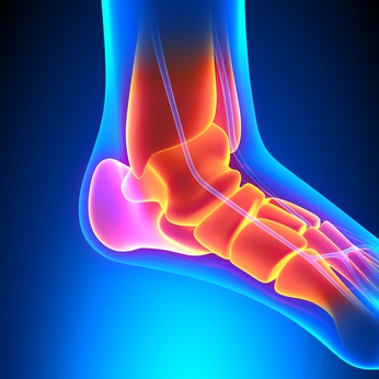 Ankle Strain, Lichfield, Physiotherapy, Sutton Coldfield, Walsall