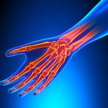 Hand Pain, Wrist Pain, Lichfield, Cannock, Physiotherapy, Sutton Coldfield