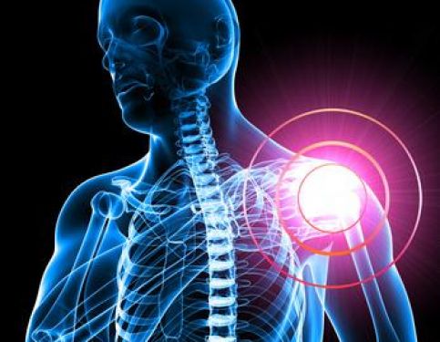 Shoulder Surgery Vs Physiotherapy Part 2